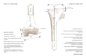 LEFT Knee Insert - Tibia Adjustable Valgus - no Patella (Pack of 25)