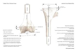 LEFT Knee Insert - Neutral - no Patella (Pack of 25)