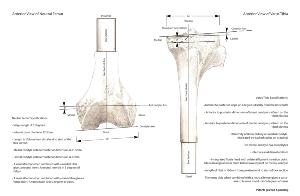 LEFT Knee Insert - Tibial Adjustable Varus - no Patella (Pack of 25)